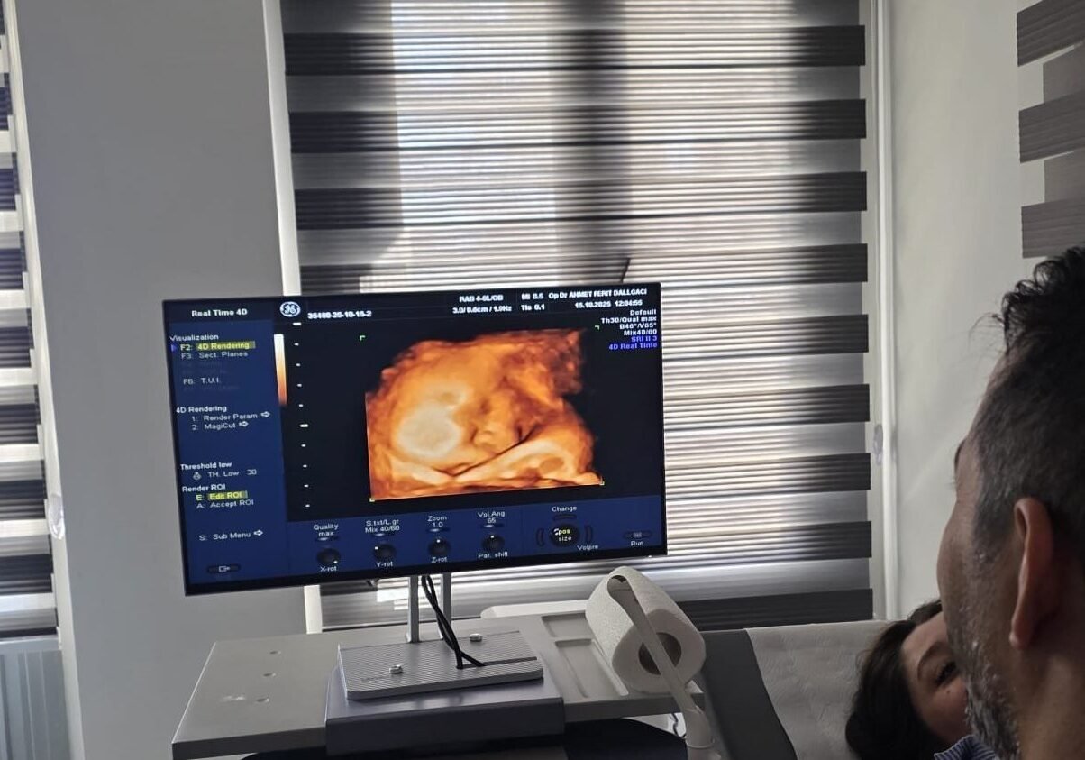 Gebelik ultrason görüntülemesi